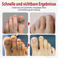 Japan NailRenew™ Onychomycosis Quick Relief Oil | 1+1 ZDARMA