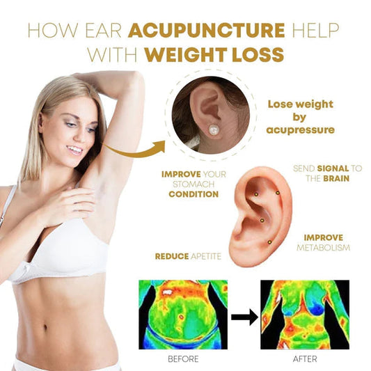 (Korlátozottan kapható 🔥 utolsó nap) Elegance Lymphvity MagneTherapy Fehér Onyx fülbevalók