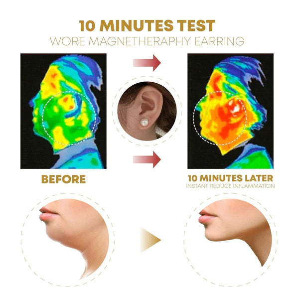 (Korlátozottan kapható 🔥 utolsó nap) Elegance Lymphvity MagneTherapy Fehér Onyx fülbevalók